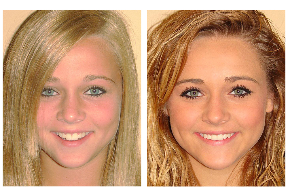 William L. Krell, DDS, MAGD