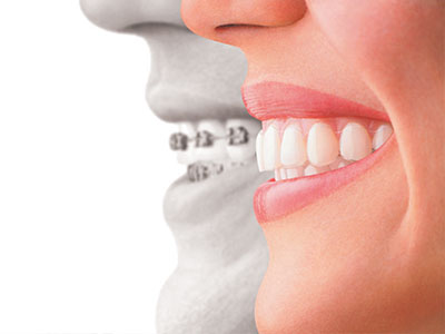 William L. Krell, DDS, MAGD | Emergency Treatment, Digital Impressions and Fluoride Treatment
