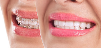 William L. Krell, DDS, MAGD | Dental Bridges, Crowns and Oral Cancer Screening