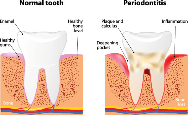 William L. Krell, DDS, MAGD | Intraoral Camera, CEREC and Implant Restorations