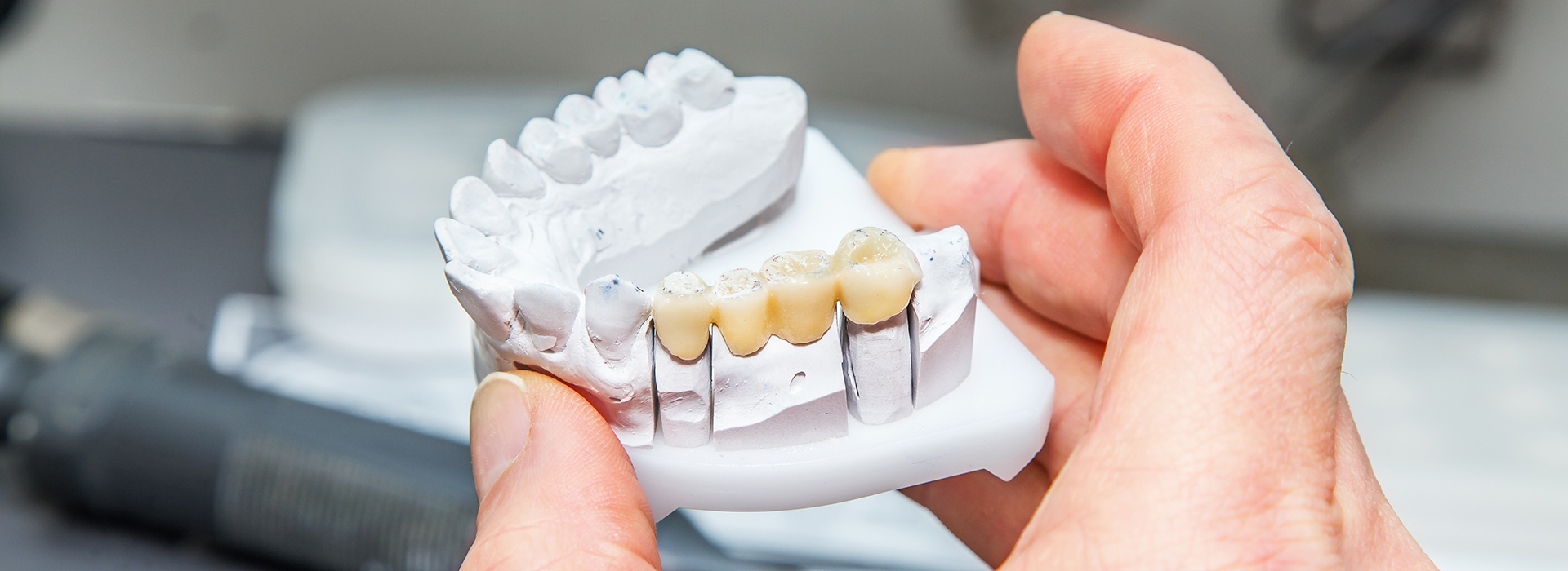 William L. Krell, DDS, MAGD | Periodontal Treatment, Laser Dentistry and Implant Restorations
