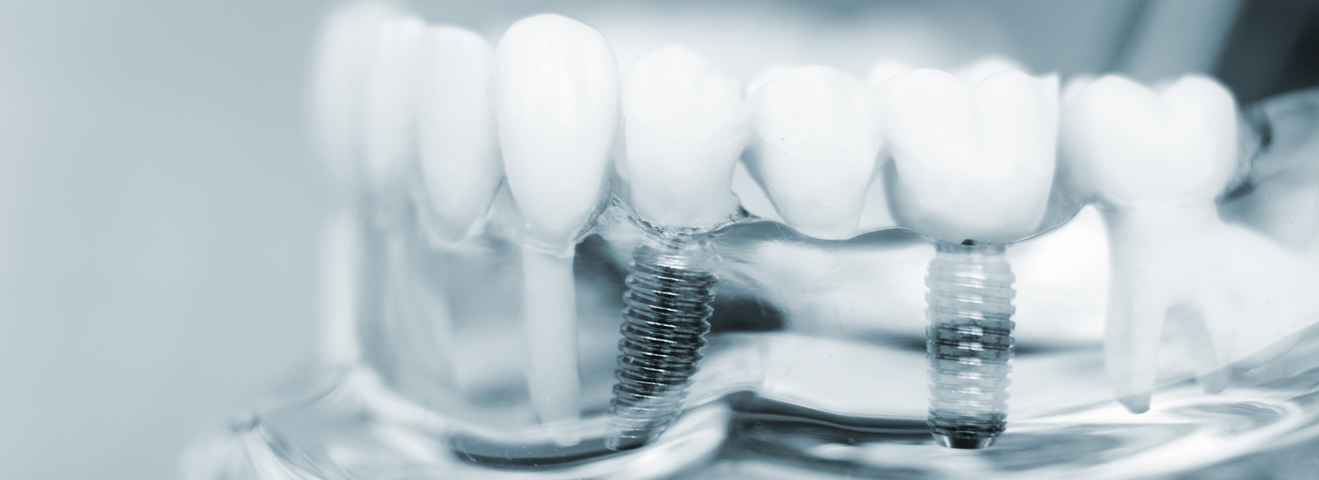 William L. Krell, DDS, MAGD | Laser Dentistry, Invisalign reg  and Pediatric Dentistry