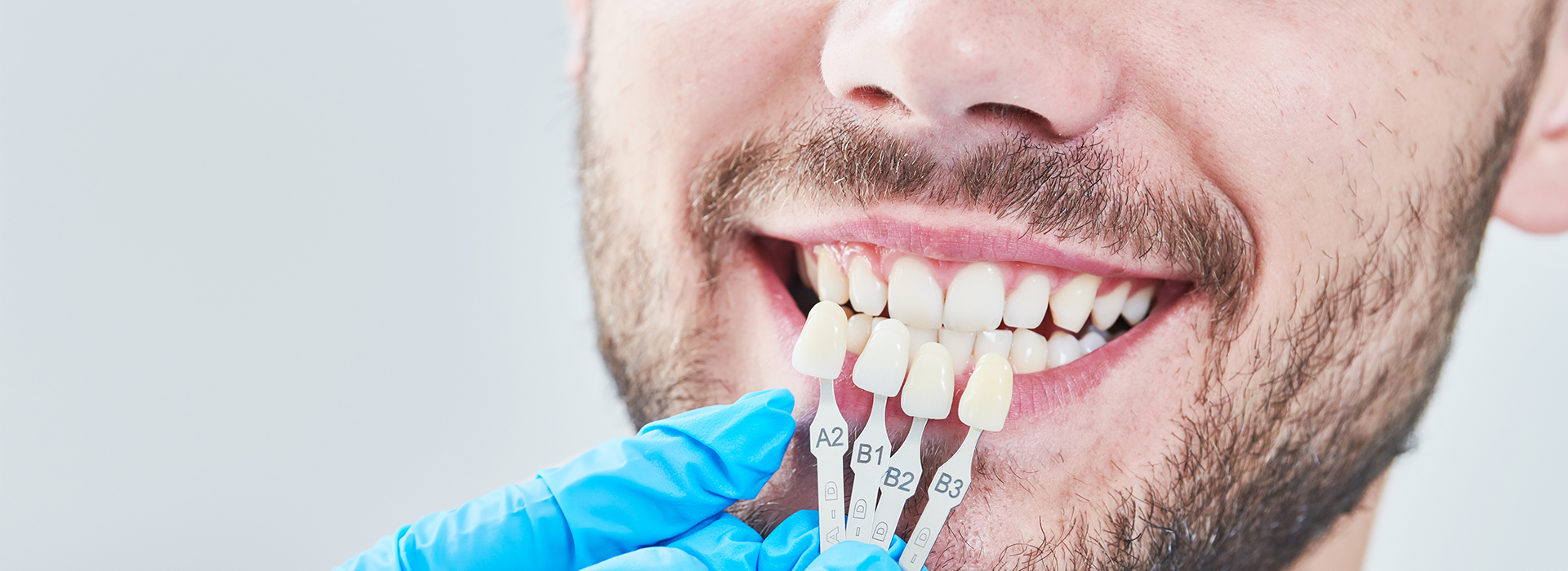 William L. Krell, DDS, MAGD | Root Canals, Dental Fillings and Ceramic Crowns
